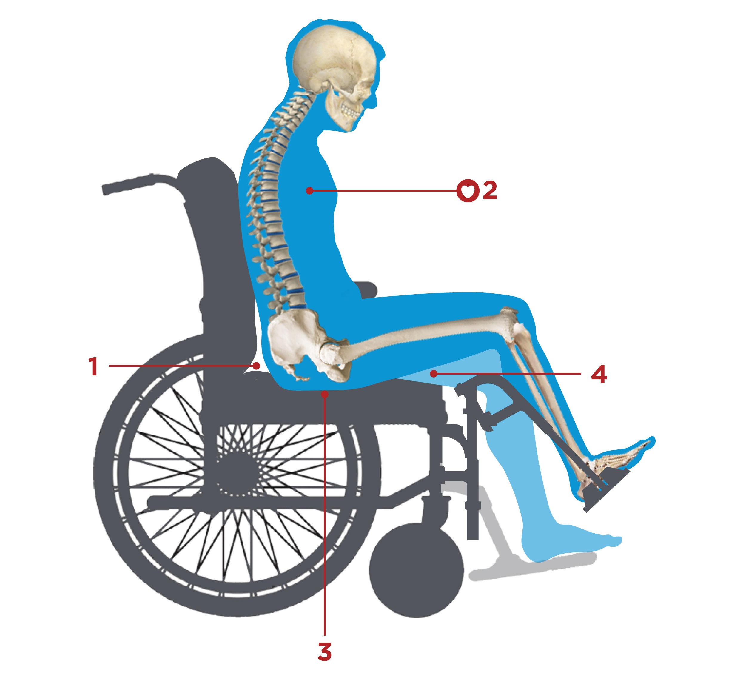 Wheelchair Seating & Positioning Guide